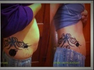 Timm Handegard Before and After Pictures