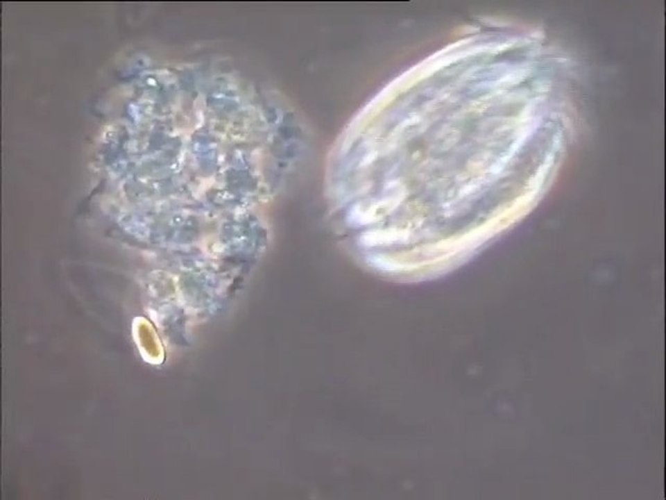 Examen des boues activées du Carré de Réunion : observation et détail des faunes protozoaires