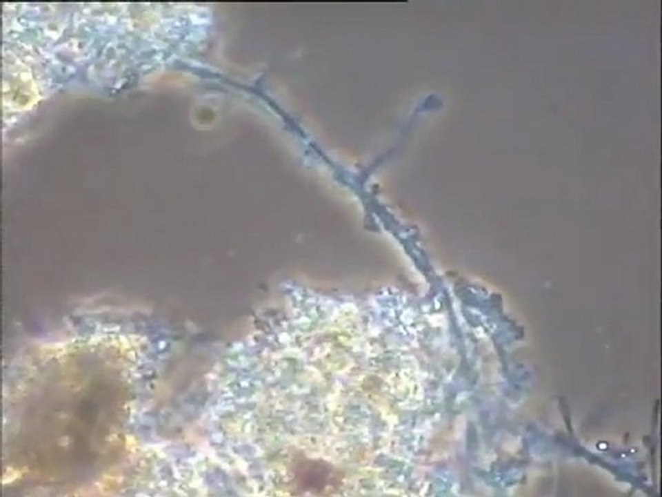 Examen des boues activées du pilote d’essai du CRITER sur SBR (sequencing batch reactor)