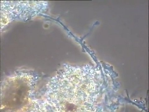Examen des boues activées du pilote d’essai du CRITER sur SBR (sequencing batch reactor)