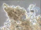 Examen des biomasses du sessile n° 1 de Noisy-le-Grand : observation d'une collection de micro-organismes