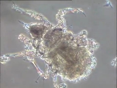 Observation d'un acarien du sessile de Noisy-le-Grand