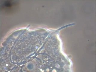 Images d'ingestion d'un filament bactérien par une amibe - très gros plan