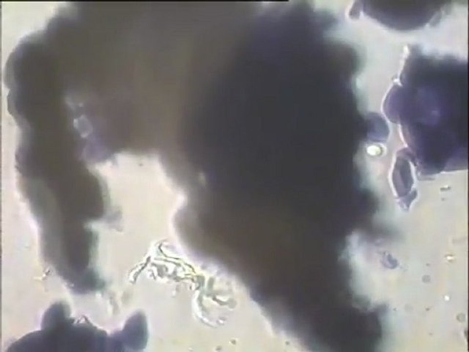 Observation de pâtes à pain fraîches et cuites et d'une pâte de cake au microscope à fort grossissement