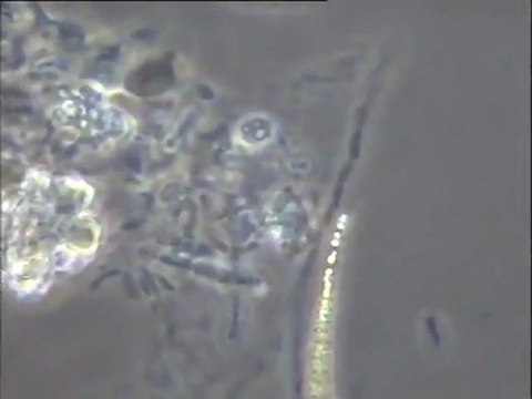 Examen de la boue native de la file Achères IV et de la boue contaminée des EPI