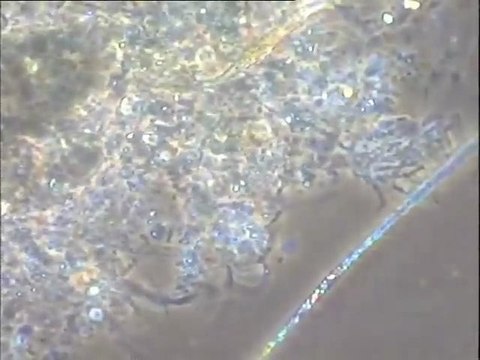 Examen de la boue contaminée des filtres EPI âgée d'une semaine : observation des faunes