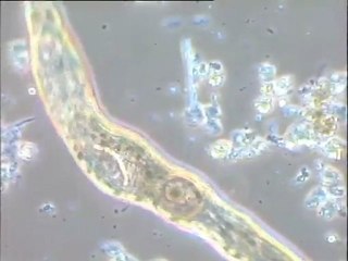 Examen d'une boue activée âgée d'un mois conserve au laboratoire : second examen des faunes