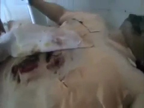 فري برس حلب عندان اصابة الشهيد المجهول الهوية 2 4 2012