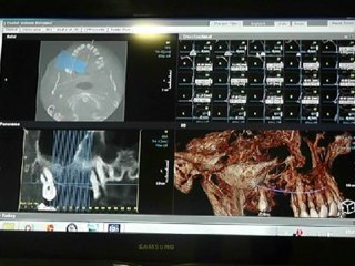 İztomer Radyoloji Merkezinde Kullanılan Ondeman 3D Programının Kullanım Videosu