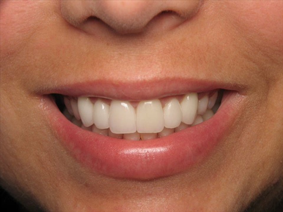 Dental search engine optimization by 5280Click Denver Online Marketing