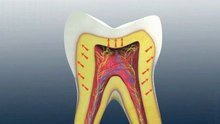 Dental 3D Animation