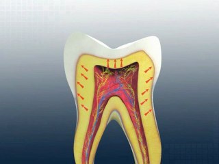Dental 3D Animation