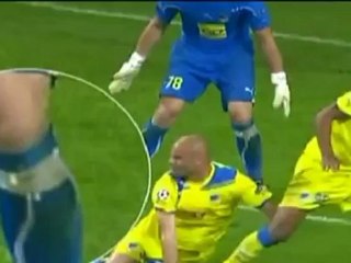 Los 2 dientes de Paulo Jorge en el Bernabeu!