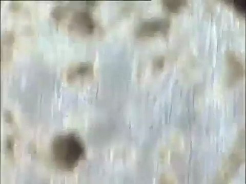 Examen de boues filamenteuses d'Achères IV puis d'Achères III au microscope (bassin combiné)