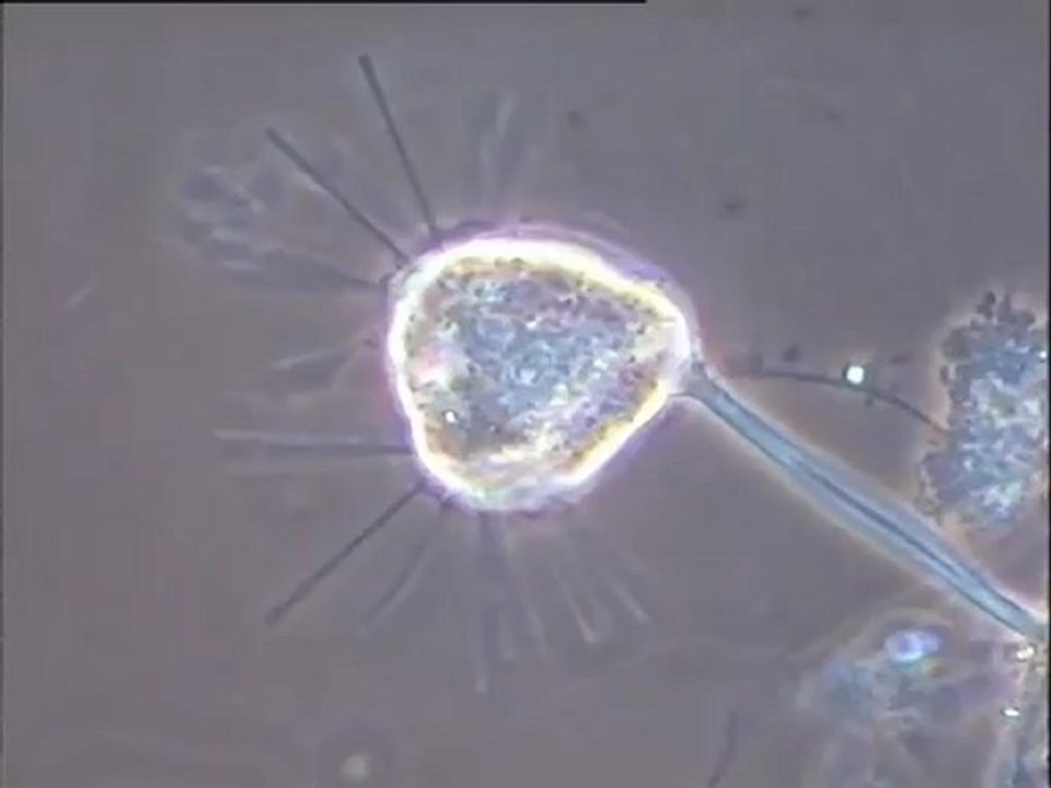 Examen de la boue d'une station d'aération sans décanteur alimentée par un effluent de porcherie (Limousin) : boue filamenteuse stabilisée