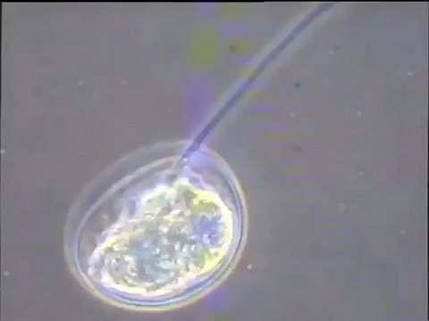 Examen de thécamibes Arcella en gros plan et scène de prédation d'un filament bactérien