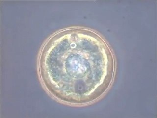 Thécamibes Arcella sur fibres de cellulose (échantillon ERM de la papeterie de la ville de Thiers) et prédation entre amibes