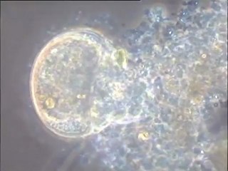 Prédation d’une Arcella par une autre amibe