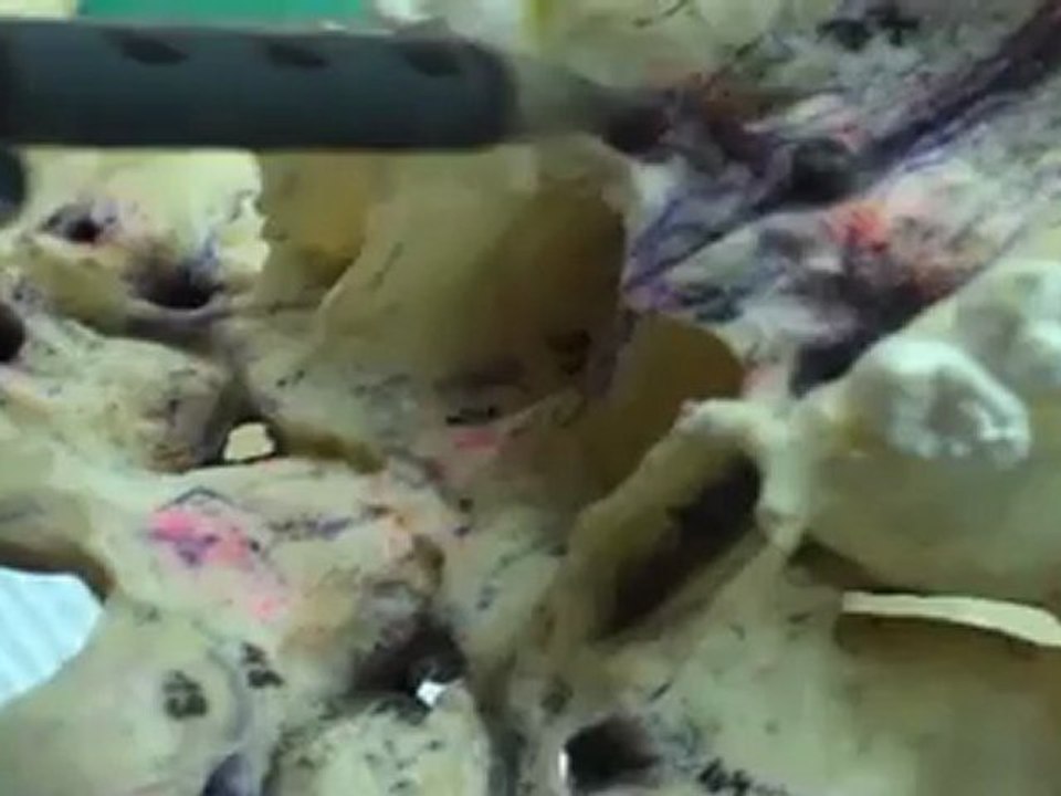 kafatası kemik-tkr-