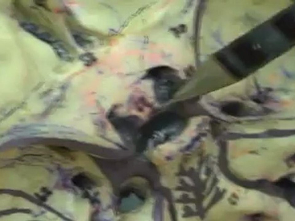 kafatası kemik 2-tkr-