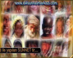 Elif Sünnet Merkezi Ankara ( Circumcision )