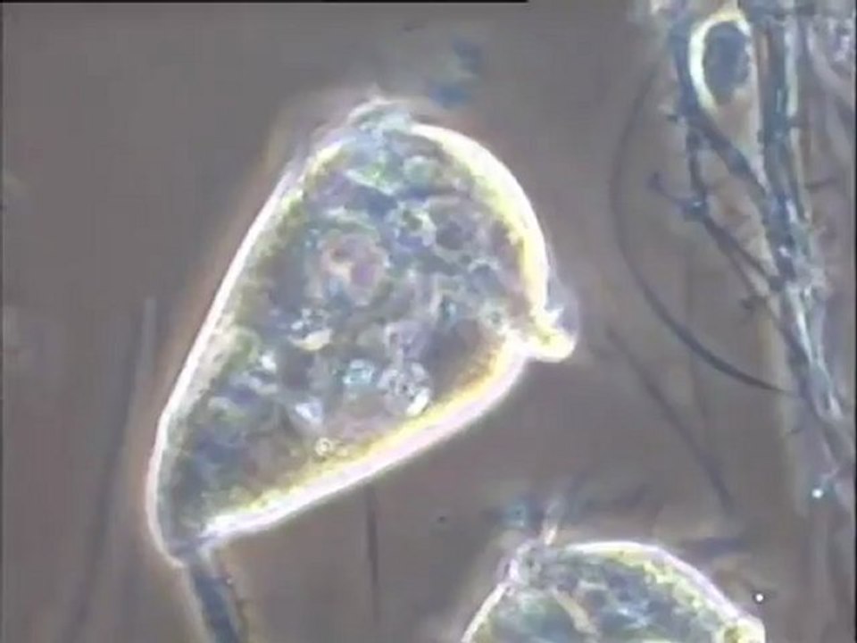 Examen d'un échantillon de boue activée filamenteuse du bassin combiné Degrémont, avant le biofor