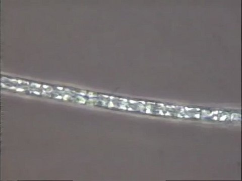 Eutrophisation de l'étang de Montboiron : examen des biomasses aquatiques, des algues en particulier