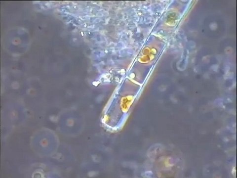 Examen des boues de lavage du Biofor au microscope (fort grossissement)