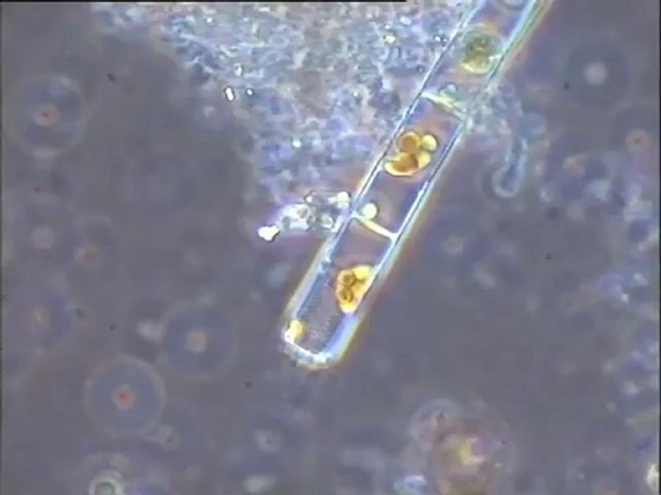 Examen des boues de lavage du Biofor au microscope (fort grossissement)