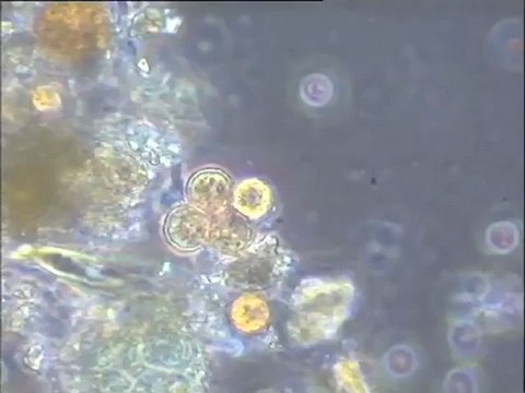 Examen d'un échantillon de terre d'Achères, contaminée par des micro-organismes