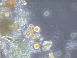 Examen d'un échantillon de terre d'Achères, contaminée par des micro-organismes