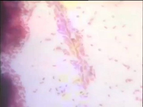 Examen d’échantillons de boues industrielles Irepolia et d’échantillons du biofor (mousse, boue de lavage) en coloration Gram