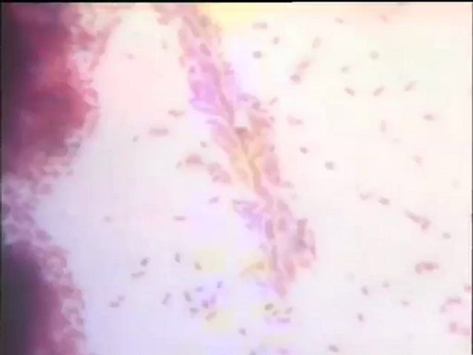 Examen d’échantillons de boues industrielles Irepolia et d’échantillons du biofor (mousse, boue de lavage) en coloration Gram