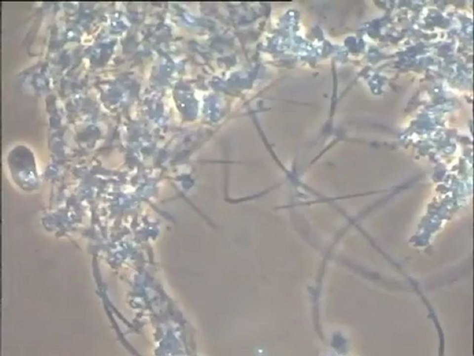 Examen d’une préparation de fibres de cellulose conservées dans l’urine et ensemencées avec une boue activée