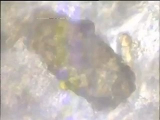 Observation d'oeufs de nématodes parasites dans une préparation de matières fécales