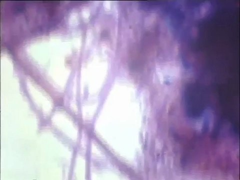 Observation d’une préparation de boue en coloration Gram à fort grossissement : types morphologiques de filaments