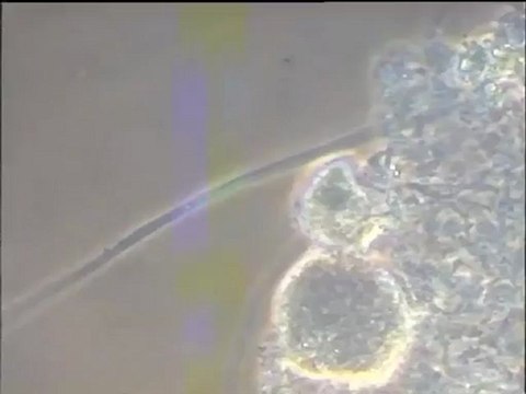Examen d'une boue activée au microscope à contraste de phase, fort grossissement