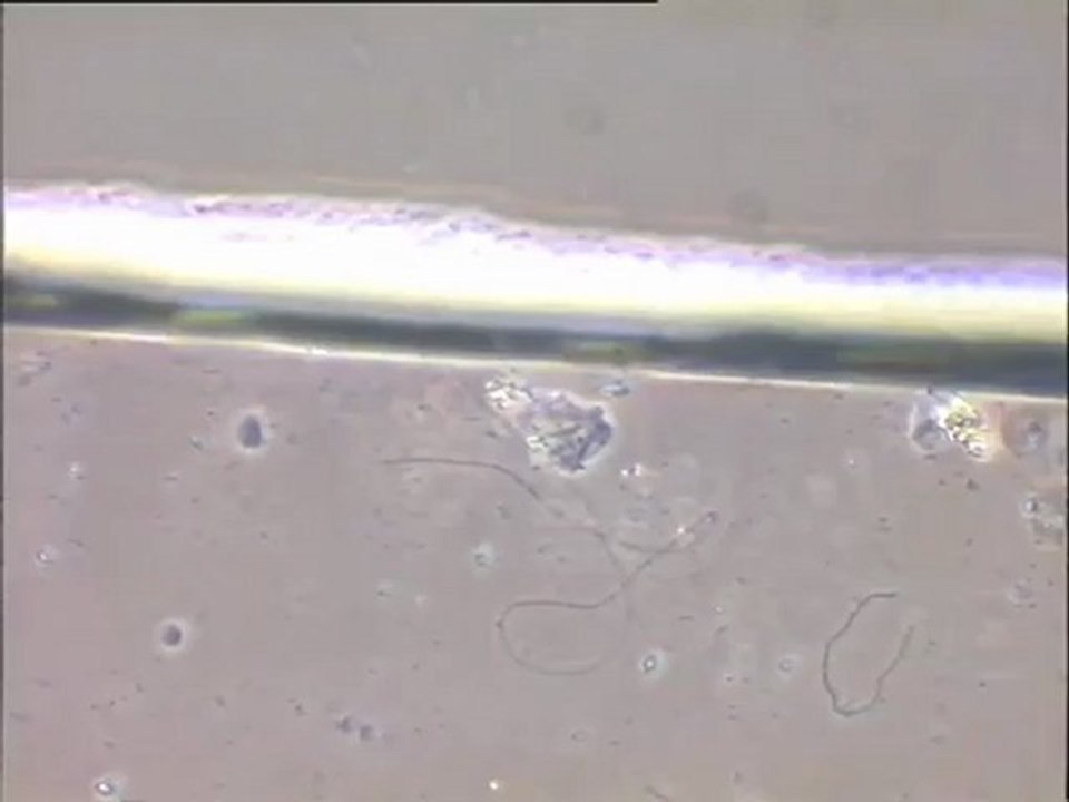 Examen de boues activées de Noisy le Grand traitées au chlorure ferrique (FeCl3) et comptage de filaments
