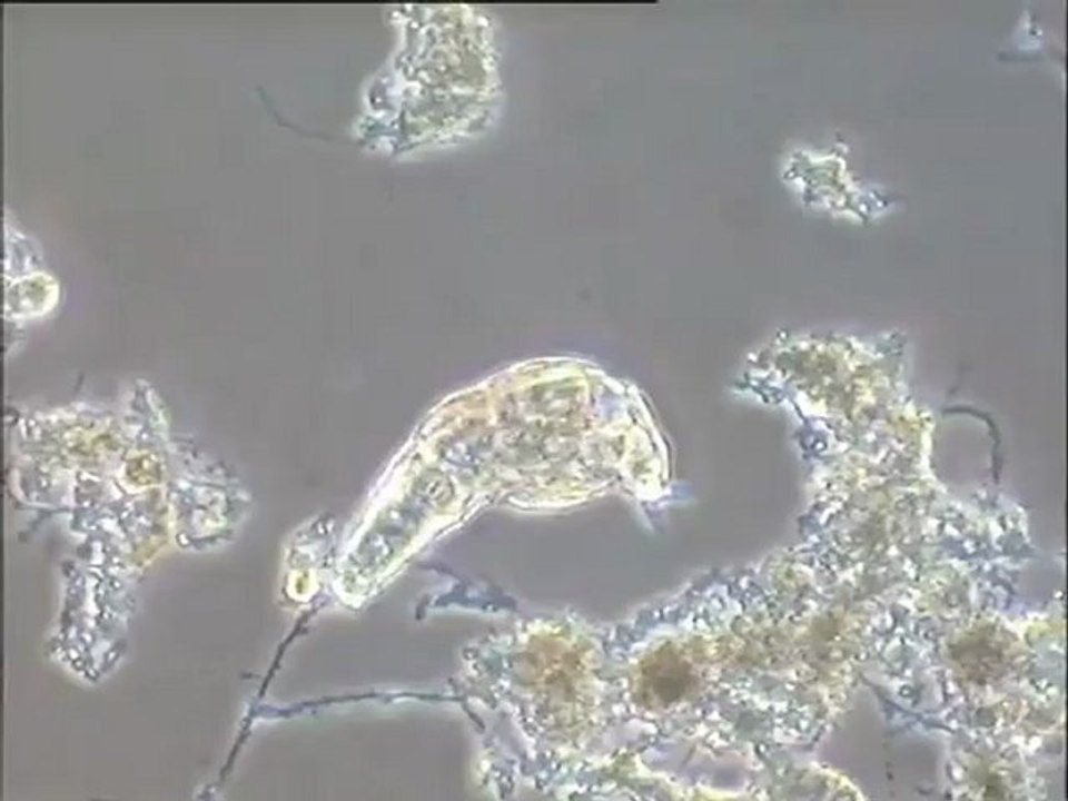 Examen d’une boue activée de la station de Versailles