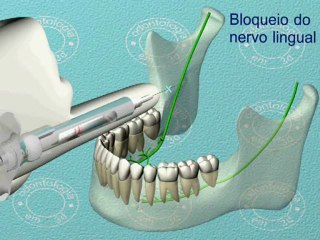 нижняя челюсть 3