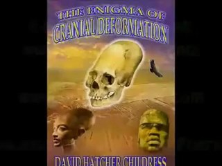 différents.cranes.( humain). Pérou