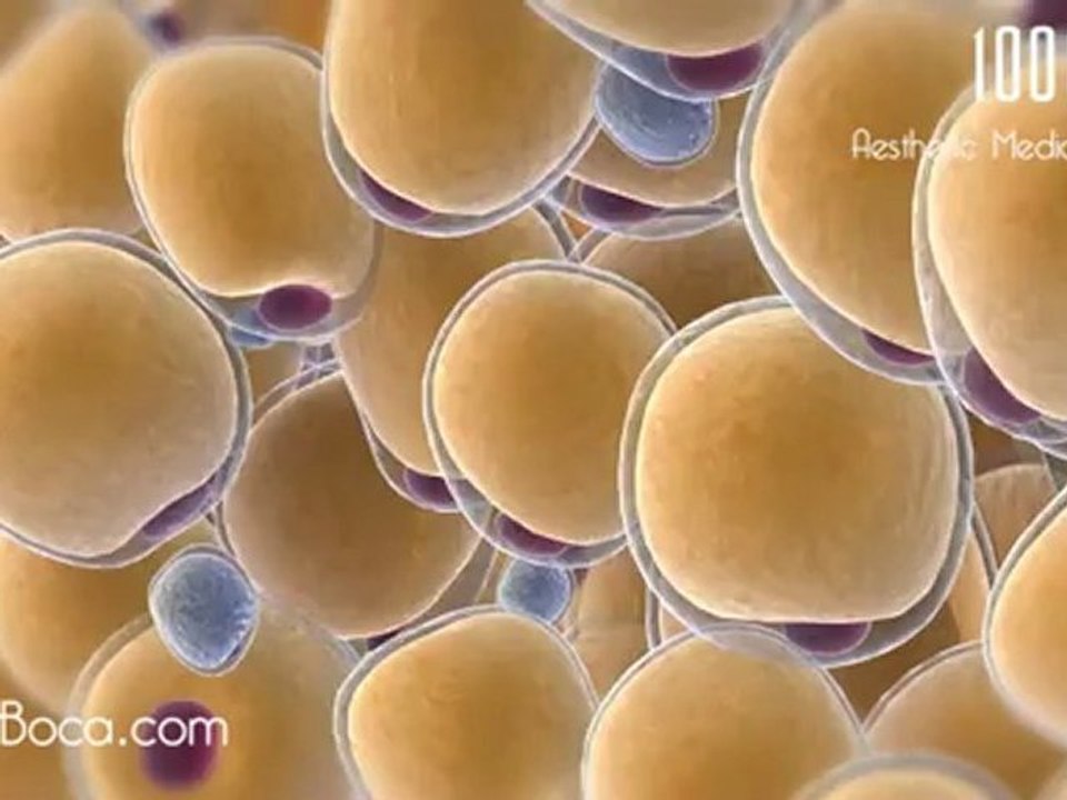 Boca Raton CoolSculpting at 1001 Medical Center