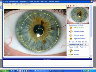 Software iridologia - Demostracion AIGAL