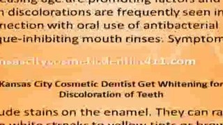 Kansas City Cosmetic Dentist Whitening Discoloration Teeth