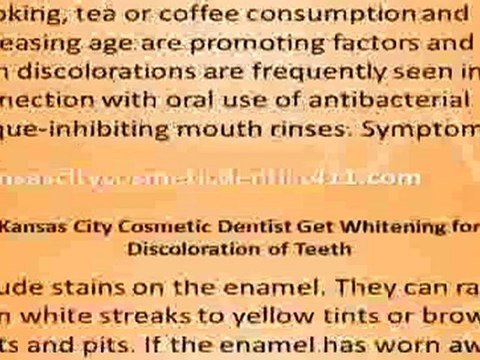 Kansas City Cosmetic Dentist Whitening Discoloration Teeth