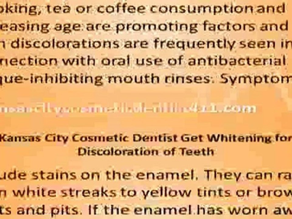 Kansas City Cosmetic Dentist Whitening Discoloration Teeth