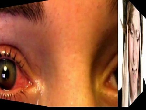 causes low blood pressure - symptom of low blood pressure - treatment for low blood pressure