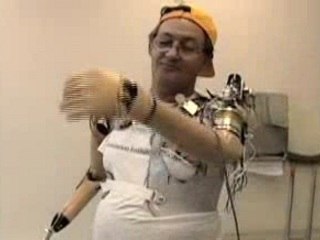 Bras bionique