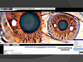 MANUAL DEL PROGRAMA DE ANALSIS IRIDOLOGICO