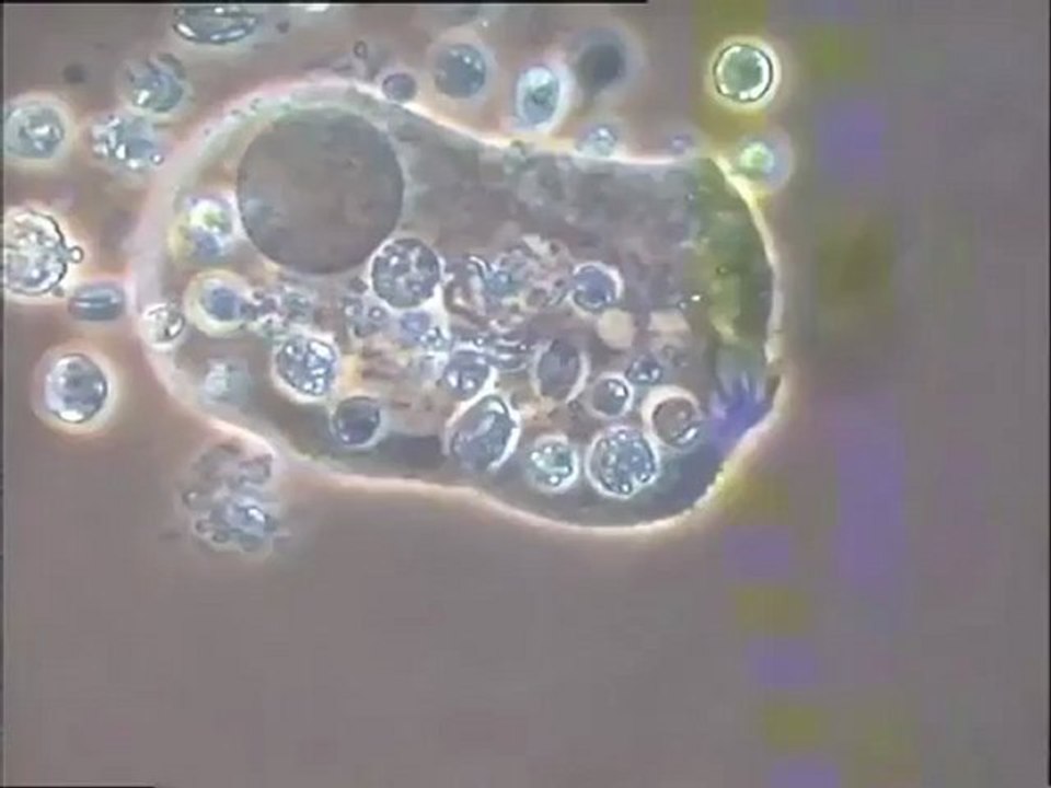 Observation des biomasses déposées sur le filtre de charbon actif : scènes d'excrétion cellulaire chez les protozoaires
